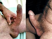 dick image