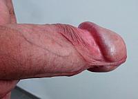 dick image