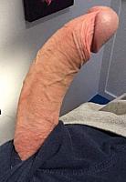 image of a penis