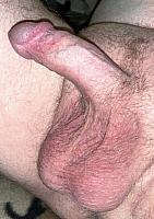 penis photo