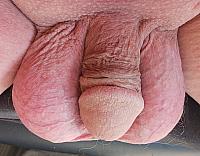 penile